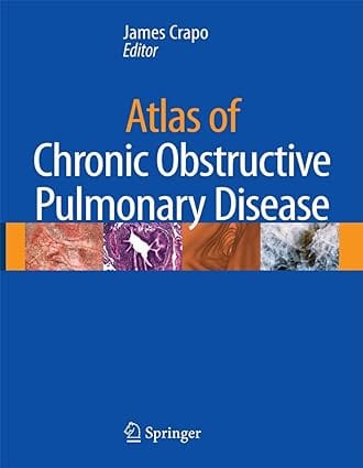 Atlas Of Chronic Obstructive Pulmonary Disease 2009 by Crapo J.D.