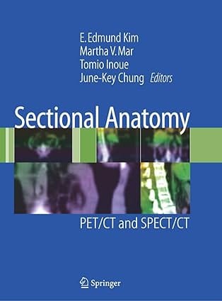 Sectional Anatomy: Pet/Ct And Spect/Ct 2007 By Kim E E