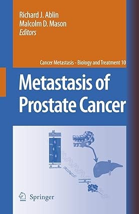 Metastasis Of Prostate Cancer 2007 By Ablin R J