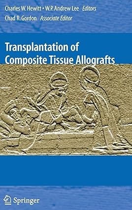 Transplantation Of Composite Tissue Allografts 2007 By Hewitt C W