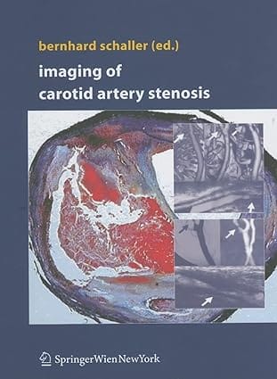 Imaging Of Carotid Artery Stenosis 2007 By Schaller B