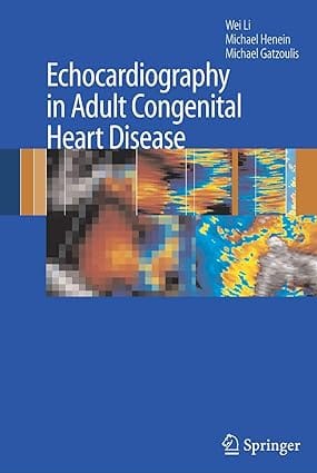 Echocardiography In Adult Congenital Heart Disease 2007 By Li W