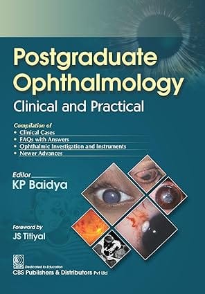 Postgraduate Ophthalmology Clinical And Practical 2024 By Kp Baidya