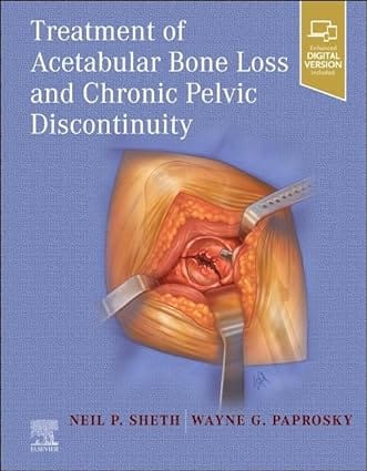 Treatment Of Acetabular Bone Loss And Chronic Pelvic Discontinuity With Access Code 2024 By Sheth N P