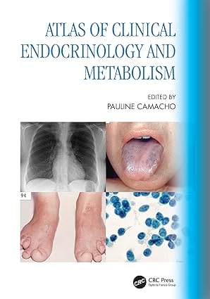 Atlas Of Clinical Endocrinology And Metabolism 2024 By Camacho P