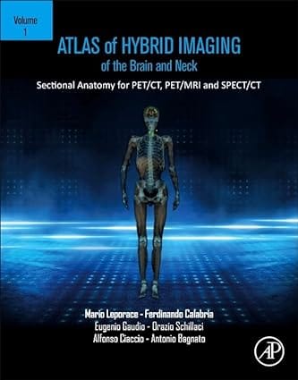 Atlas Of Hybrid Imaging Sectional Anatomy For Pet Ct Pet Mri And Spect Ct Brain And Neck Volume 1 2023 By Leporace M