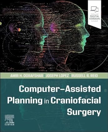 Computer Assisted Planning In Craniofacial Surgery With Access Code 2024 By Dorafshar A H