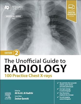 The Unofficial Guide To Radiology 100 Practice Chest X Rays With Access Code 2nd Edition 2024 By Al-Hadithi A B A K