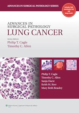 Advances In Surgical Pathology Lung Cancer 2011 By Cagle