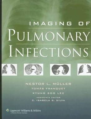 Imaging Of Pulmonary Infections 2007 By Muller N.L.