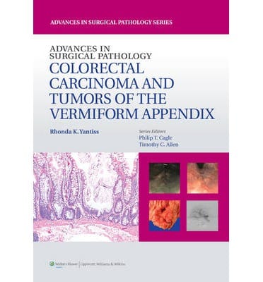 Advances In Surgical Pathology Colorectal Carcinoma And Tumors Of The Vermiform Appendix 2014 By Yantiss R
