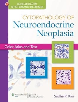 Cytopathology Of Neuroendocrine Neoplasia 2013 By Kini