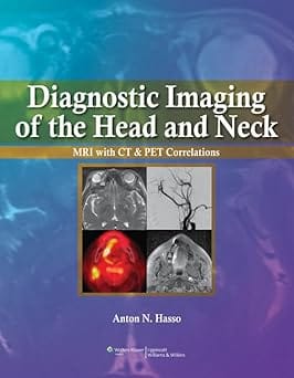 Diagnostic Imaging Of The Head And Neck Mri With Ct And Dcorrelations 2012 By Hasso A.N.