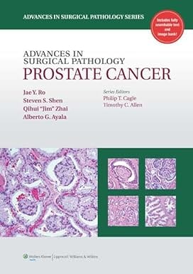 Advances In Surgical Pathology Prostate Cancer 2012 By Ro J.Y.