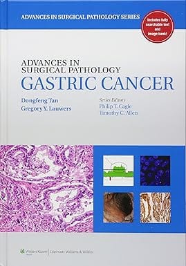 Advances In Surgical Pathology Gastric Cancer 2011 By Tan D