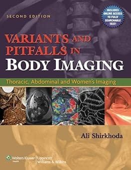 Variants And Pitfalls In Body Imaging Thoracic Abdominal And Womens Imaging 2nd Edition 2011 By Shirkhoda