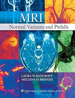 Mri Normal Variants And Pitfalls 2009 By Bancroft L W