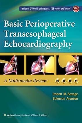 Basic Perioperative Transesophageal Echocardiography 2013 By Savage R.M.