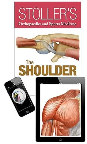 Stollers Orthopaedics And Sports Medicine The Shoulder Package 2015 By Stoller D.W.