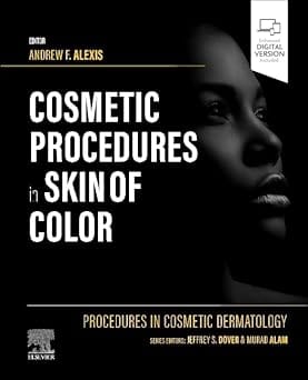 Procedures in Cosmetic Dermatology: Cosmetic Procedures in Skin of Color 1st Edition 2023 By Alexis