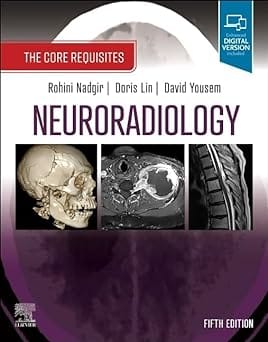 Neuroradiology 5th Edition 2023 By Nadgir