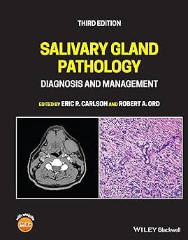 Salivary Gland Pathology Diagnosis And Management 3rd Edition 2021 By Carlson E R