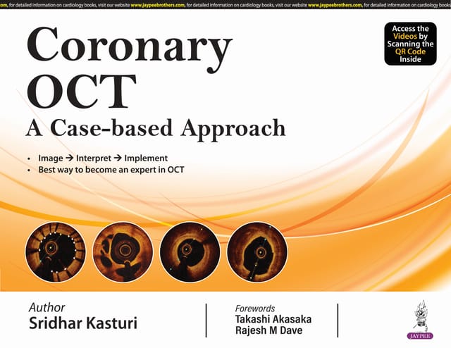 Coronary Oct A Case-Based Approach 2024 By Sridhar Kasturi