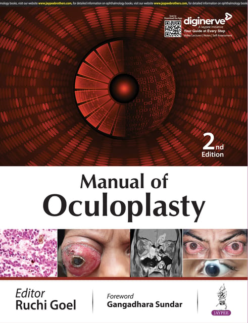 Manual Of Oculoplasty 2024 By Ruchi Goel