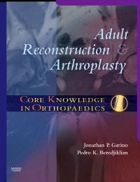 Core Knowledge In Orthopaedics Adult Reconstruction And Arthroplasty 2007 By Garino J