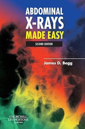 Abdominal X Rays Made Easy 2nd Edition Edition 2006 By Begg J D