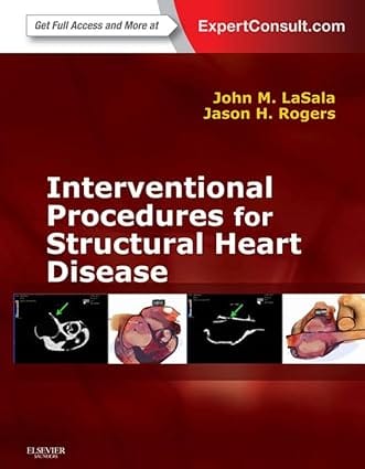Interventional Procedures For Structural Heart Disease 2014 By Lasala J M
