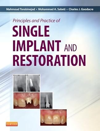 Principles And Practice Of Single Implant And Restorations 2014 By Torabinejad M