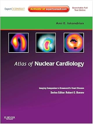 Atlas Of Nuclear Cardiology Imaging Companion To Braunwalds Heart Disease 2012 By Iskandrian A E