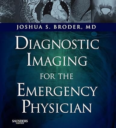Diagnostic Imaging For The Emergency Physician 2011 By Broder J S