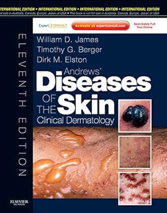 Diseases Of The Skin 1 1St Editiond Ie 2011 By James W D