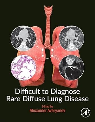 Difficult To Diagnose Rare Diffuse Lung Disease 2019 By Averyanov A