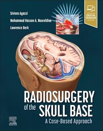 Radiosurgery Of The Skull Base A Case Based Approach With Access Code 2024 By Agazzi S