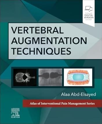 Vertebral Augmentation Techniques With Access Code 2024 By Abd-Elsayed A