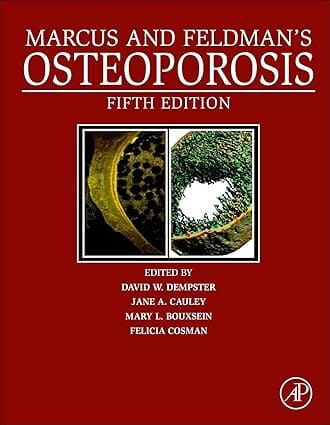 Marcus And Feldmans Osteoporosis 5th Edition 2 Vol Set 2021 By Dempster