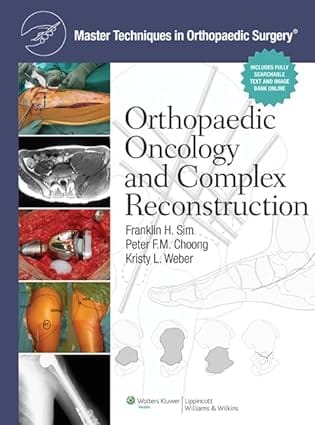 Master Techniques In Orthopaedic Surgery Orthopaedic Oncology And Complex Reconstruction 2011 By Sim F H