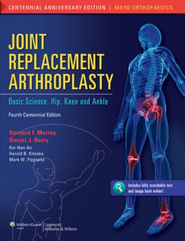 Joint Replacement Arthroplasty Basic Science Hip Knee And Ankle 4th Edition 2011 By Morrey B F