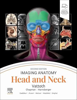 Imaging Anatomy Head And Neck With Access Code 2nd Edition 2024 By Vattoth S