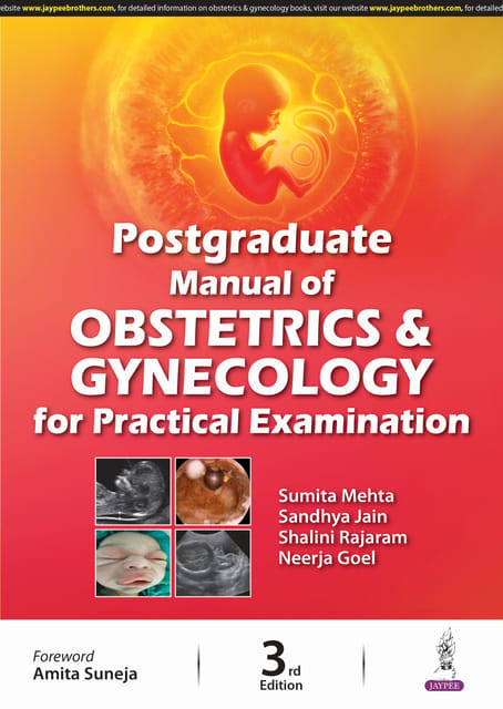 Postgraduate Manual Of Obstetrics & Gynecology For Practical Examination 3rd Edition 2024 By Sumita Mehta