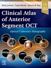 Clinical Atlas Of Anterior Segment Oct Optical Coherence Tomography With Access Code 2025 By Levinson B