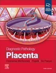 Diagnostic Pathology Placenta 3rd Edition 2024 By Heerema-Mckenney A