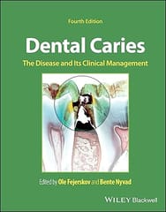 Dental Caries The Disease And Its Clinical Management 4th Edition 2025 By Fejerskov O