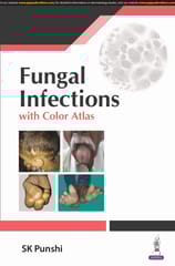 Fungal Infections With Color Altas 1st Edition 2024 By Sk Punshi