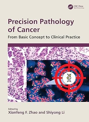 Precision Pathology Of Cancer From Basic Concept To Clinical Practice 2025 By Zhao X F