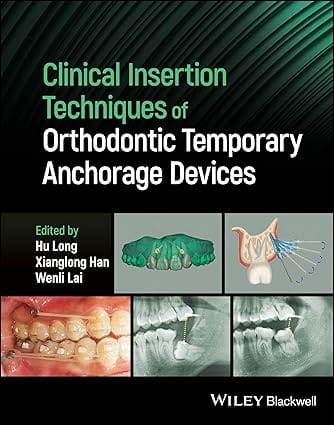 Clinical Insertion Techniques Of Orthodontic Temporary Anchorage Devices 2024 By Long H