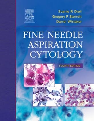 Fine Needle Aspiration Cytology 4th Edition 2005 By Orell S R